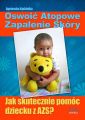 Oswoic atopowe zapalenie skory
