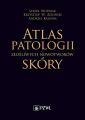 Atlas patologii zlosliwych nowotworow skory