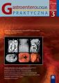Gastroenterologia Praktyczna 3/2017