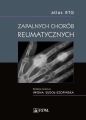 Atlas RTG zapalnych chorob reumatycznych