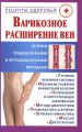 Варикозное расширение вен. Лечение традиционными и нетрадиционными методами