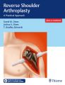 Reverse Shoulder Arthroplasty