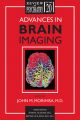 Advances in Brain Imaging