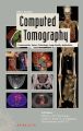 Computed Tomography. Fundamentals, System Technology, Image Quality, Applications