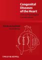 Congenital Diseases of the Heart. Clinical-Physiological Considerations