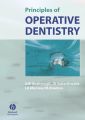 Principles of Operative Dentistry