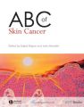 ABC of Skin Cancer