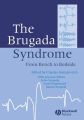 The Brugada Syndrome