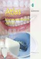 Atlas terapeutico de blanqueamiento dental