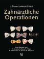 Zahnarztliche Operationen